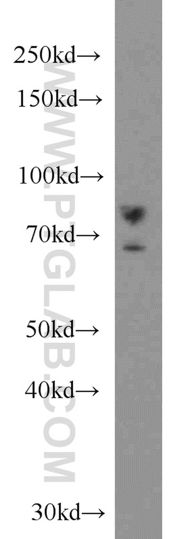 DHX32 Antibody in Western Blot (WB)