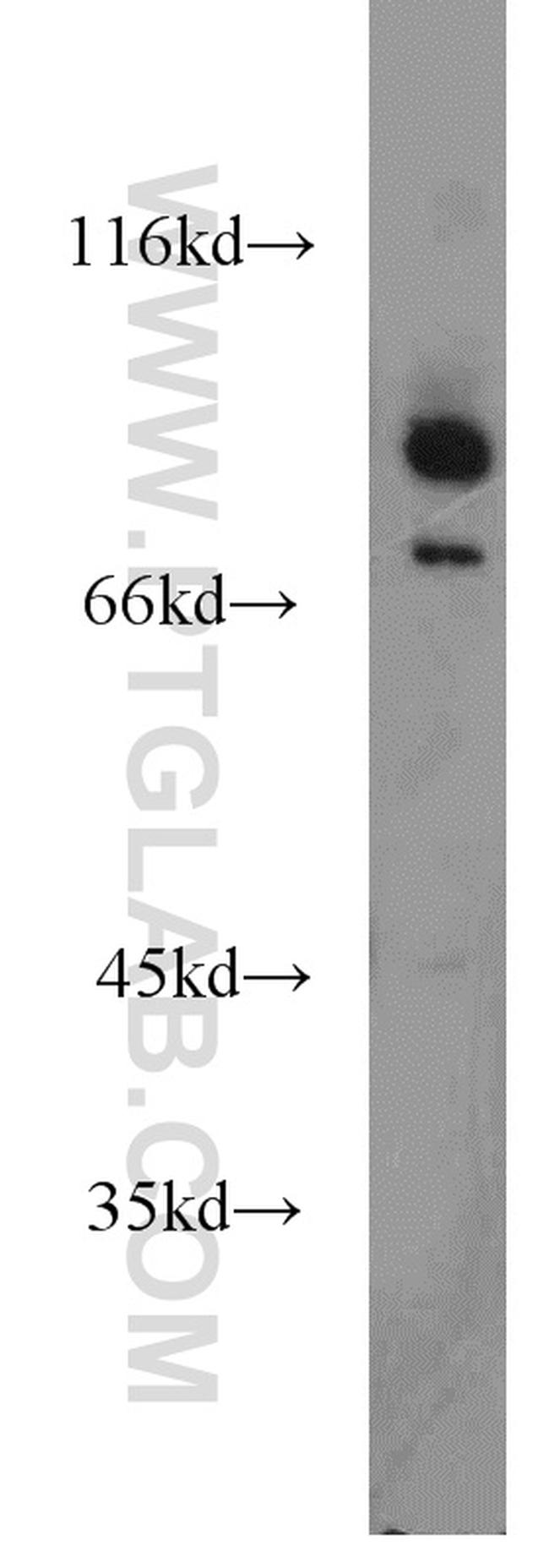 DHX32 Antibody in Western Blot (WB)