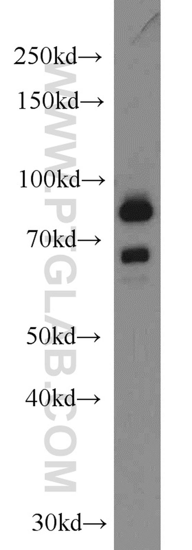 DHX32 Antibody in Western Blot (WB)