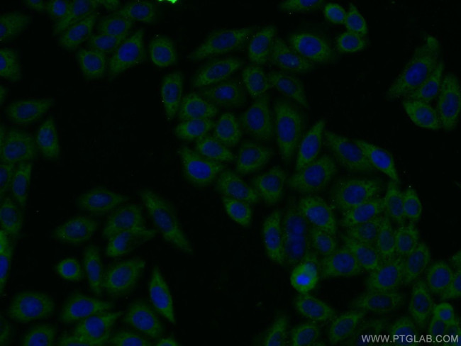 RtcB Antibody in Immunocytochemistry (ICC/IF)