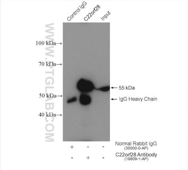 RtcB Antibody in Immunoprecipitation (IP)