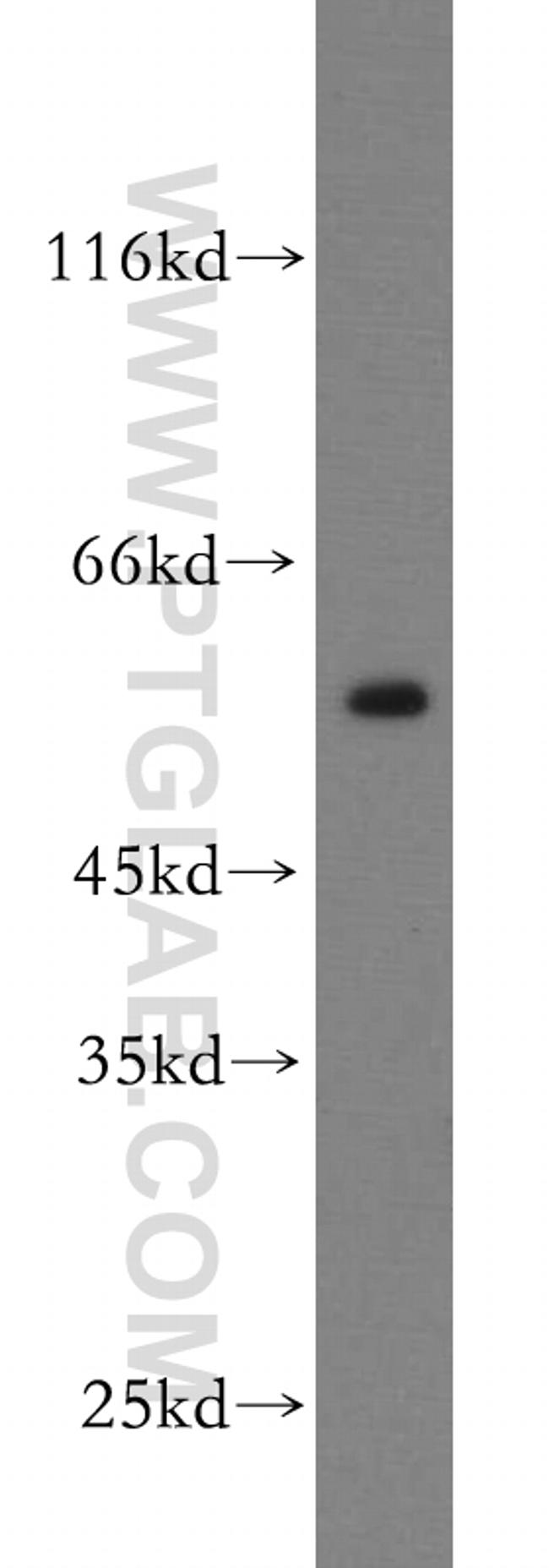 RtcB Antibody in Western Blot (WB)