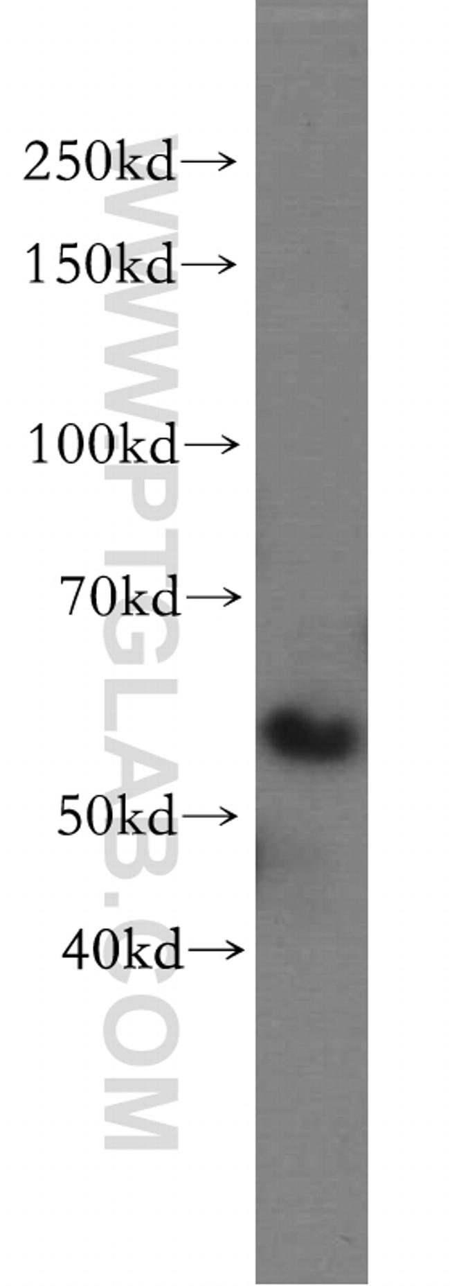 RtcB Antibody in Western Blot (WB)