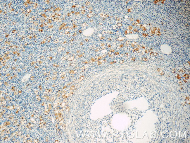 TLR5 Antibody in Immunohistochemistry (Paraffin) (IHC (P))