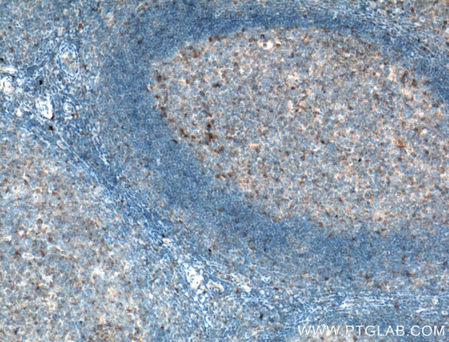 TLR5 Antibody in Immunohistochemistry (Paraffin) (IHC (P))