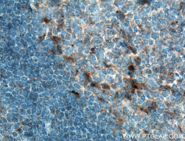 TLR5 Antibody in Immunohistochemistry (Paraffin) (IHC (P))