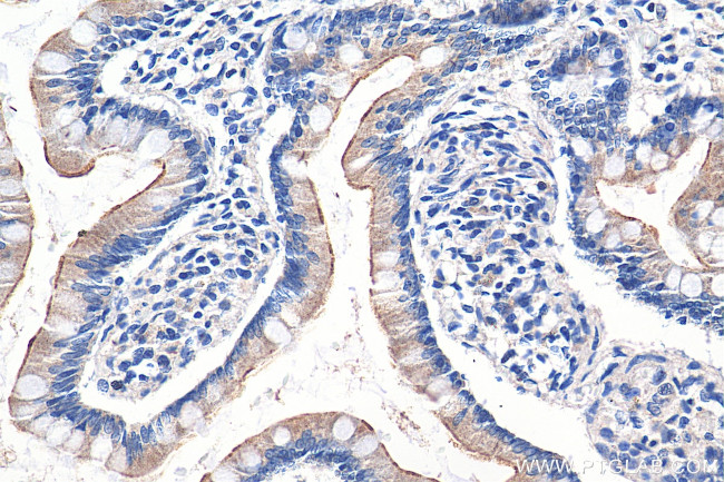 TLR5 Antibody in Immunohistochemistry (Paraffin) (IHC (P))