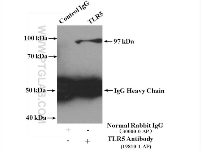 TLR5 Antibody in Immunoprecipitation (IP)