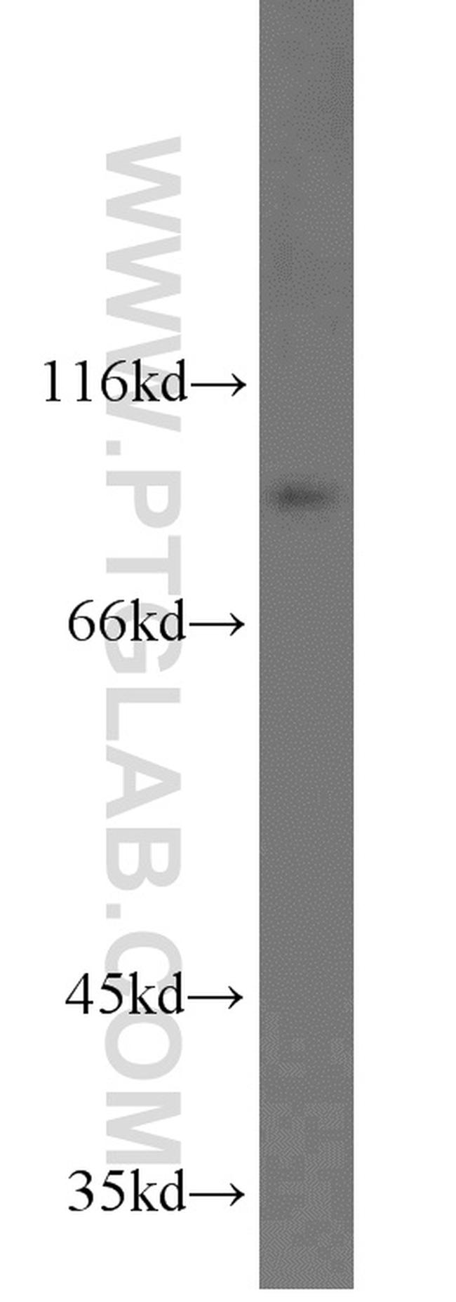 TLR5 Antibody in Western Blot (WB)