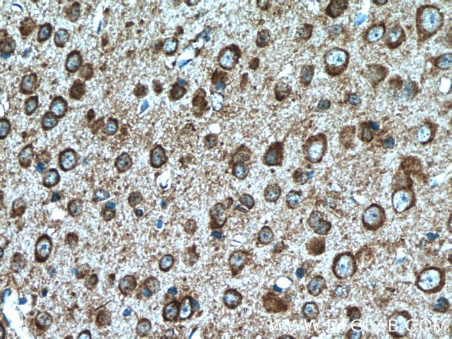 TLR4 Antibody in Immunohistochemistry (Paraffin) (IHC (P))