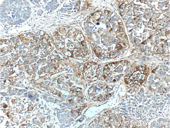 TLR4 Antibody in Immunohistochemistry (Paraffin) (IHC (P))