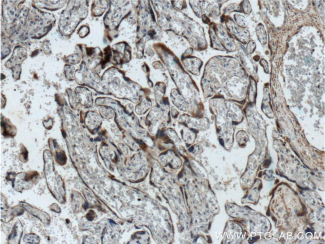 TLR4 Antibody in Immunohistochemistry (Paraffin) (IHC (P))