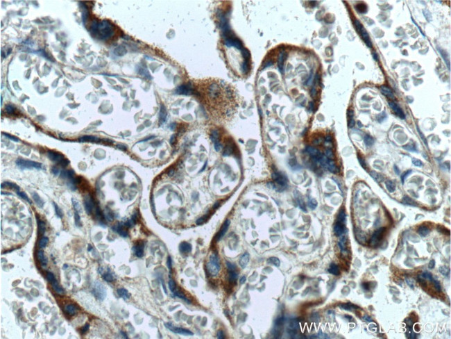 TLR4 Antibody in Immunohistochemistry (Paraffin) (IHC (P))