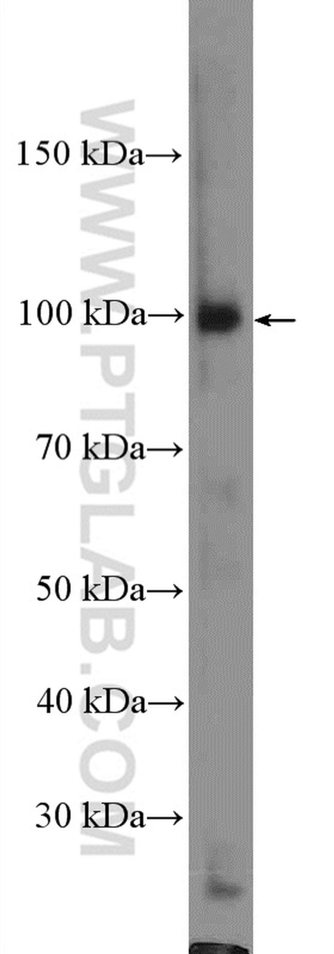 TLR4 Antibody in Western Blot (WB)