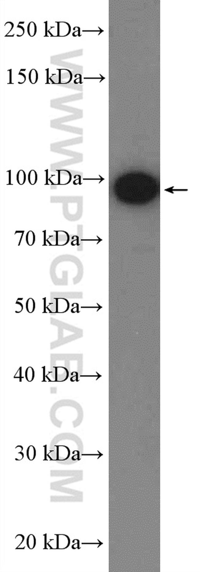 TLR4 Antibody in Western Blot (WB)