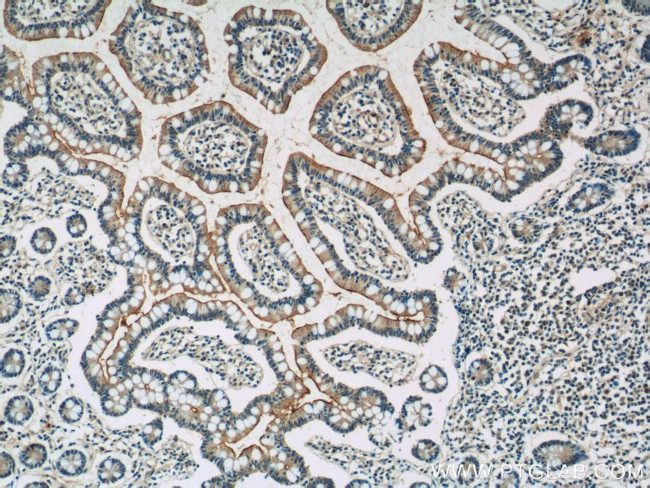 TLR1 Antibody in Immunohistochemistry (Paraffin) (IHC (P))