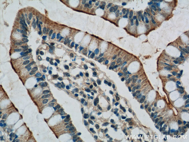 TLR1 Antibody in Immunohistochemistry (Paraffin) (IHC (P))