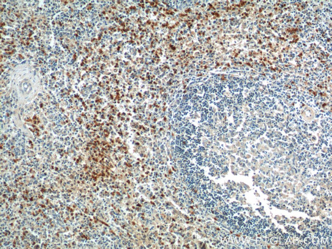 TLR1 Antibody in Immunohistochemistry (Paraffin) (IHC (P))