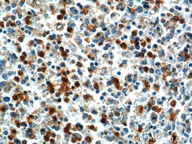 TLR1 Antibody in Immunohistochemistry (Paraffin) (IHC (P))