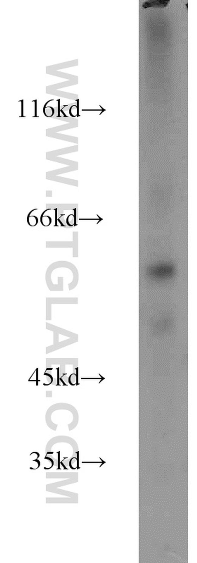 ZBTB37 Antibody in Western Blot (WB)