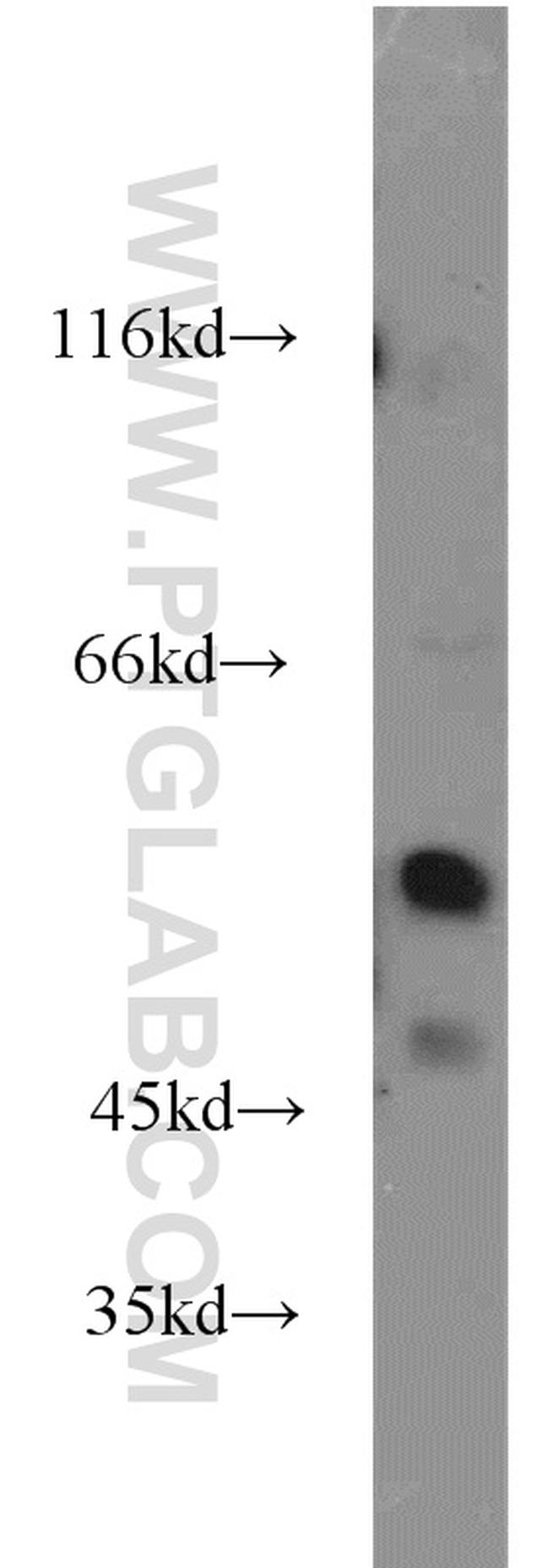 ZBTB37 Antibody in Western Blot (WB)