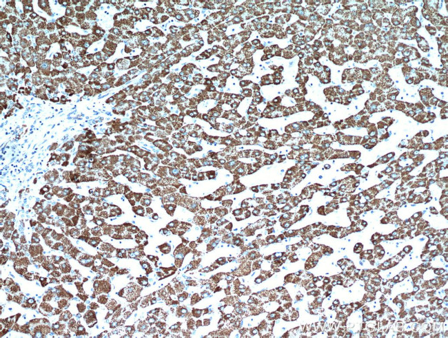 HADH Antibody in Immunohistochemistry (Paraffin) (IHC (P))