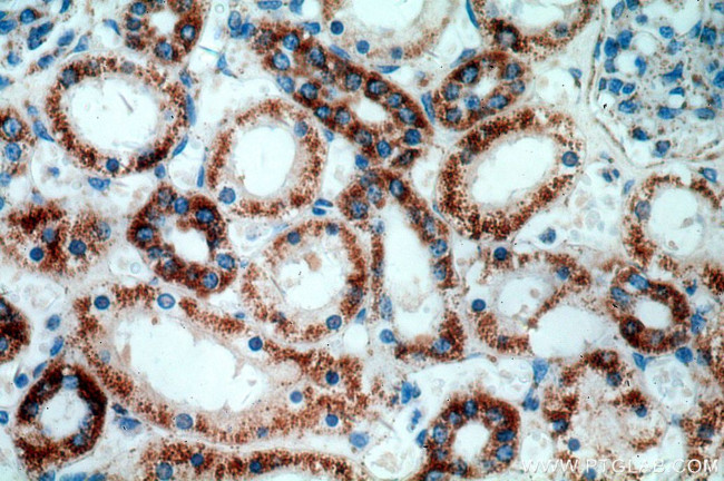 HADH Antibody in Immunohistochemistry (Paraffin) (IHC (P))