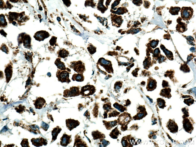 HADH Antibody in Immunohistochemistry (Paraffin) (IHC (P))