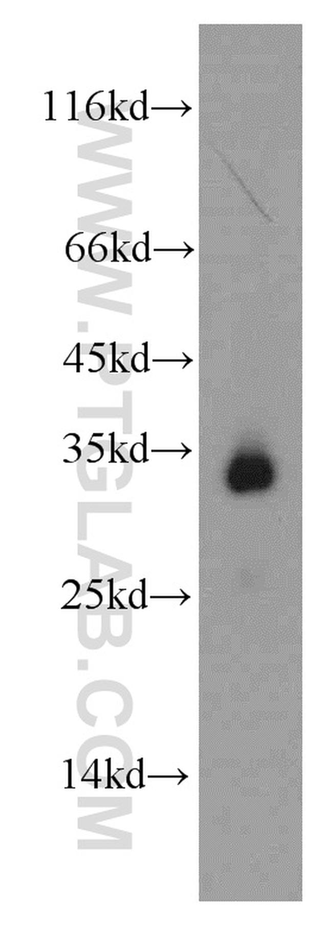 HADH Antibody in Western Blot (WB)