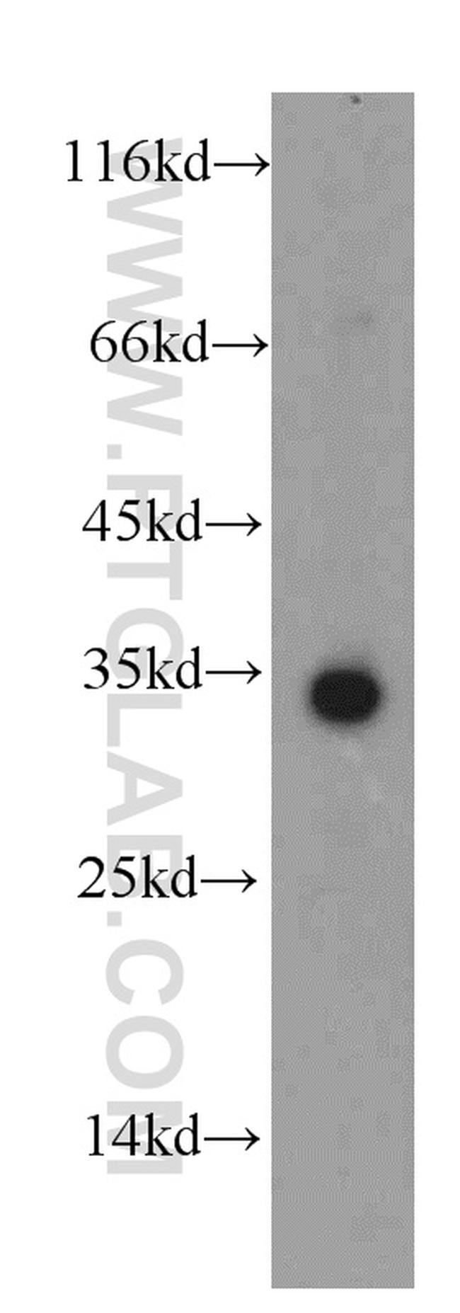 HADH Antibody in Western Blot (WB)