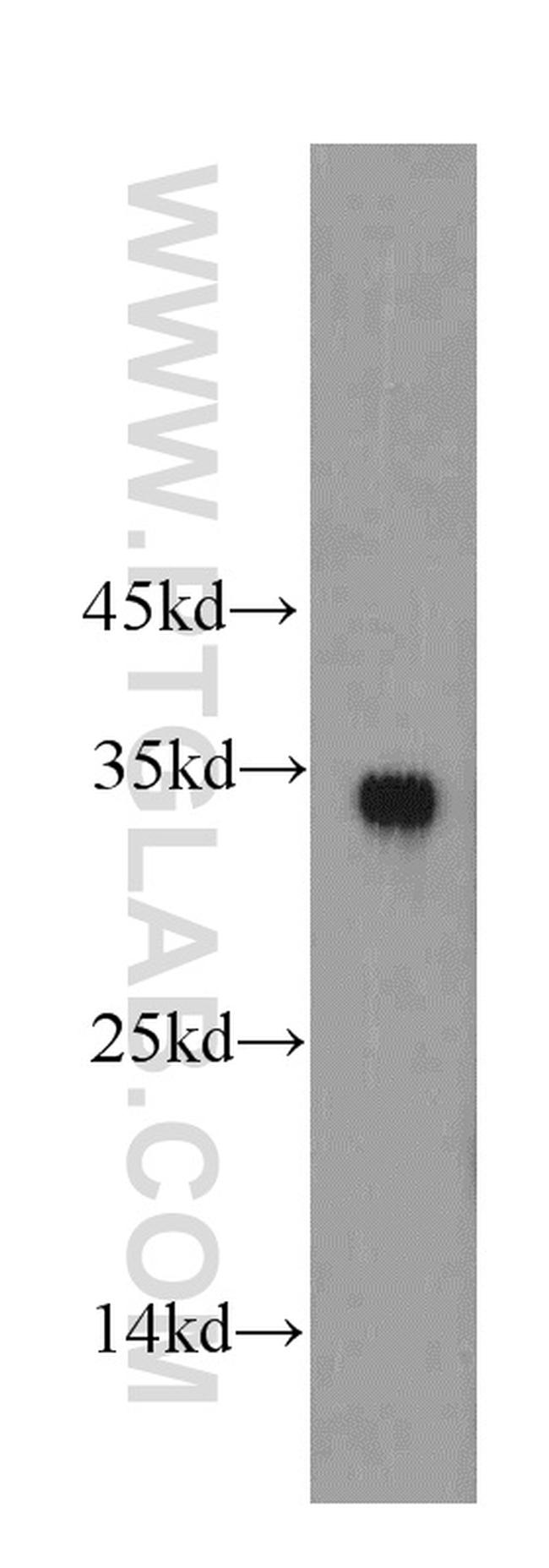 HADH Antibody in Western Blot (WB)