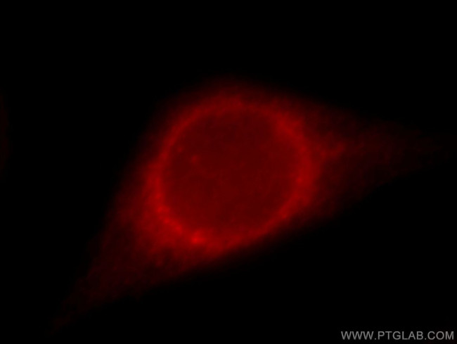 TXNDC5 Antibody in Immunocytochemistry (ICC/IF)