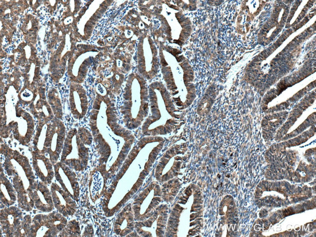 TXNDC5 Antibody in Immunohistochemistry (Paraffin) (IHC (P))