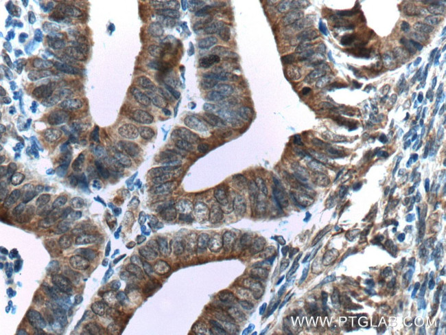 TXNDC5 Antibody in Immunohistochemistry (Paraffin) (IHC (P))