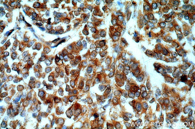 TXNDC5 Antibody in Immunohistochemistry (Paraffin) (IHC (P))