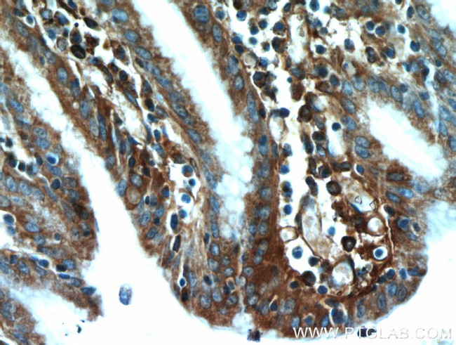 TXNDC5 Antibody in Immunohistochemistry (Paraffin) (IHC (P))