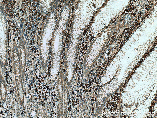 TXNDC5 Antibody in Immunohistochemistry (Paraffin) (IHC (P))