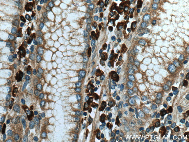 TXNDC5 Antibody in Immunohistochemistry (Paraffin) (IHC (P))