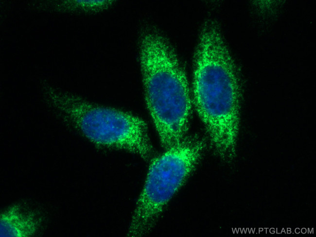 KTN1 Antibody in Immunocytochemistry (ICC/IF)