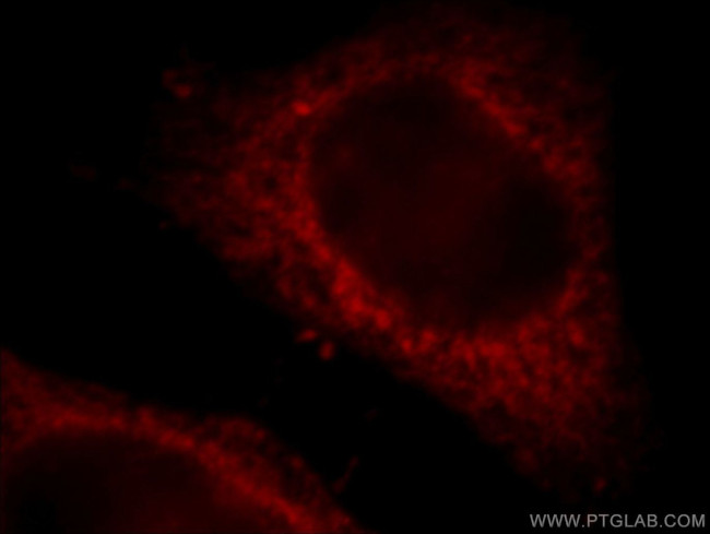 KTN1 Antibody in Immunocytochemistry (ICC/IF)