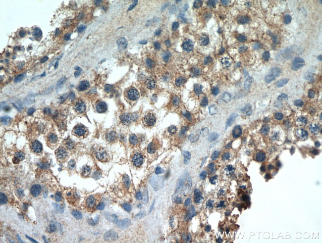 KTN1 Antibody in Immunohistochemistry (Paraffin) (IHC (P))