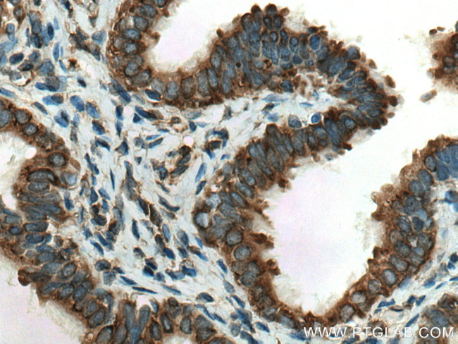 KTN1 Antibody in Immunohistochemistry (Paraffin) (IHC (P))