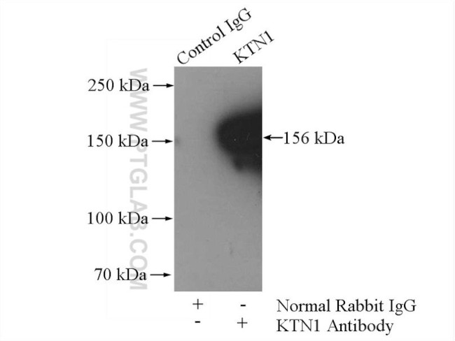 KTN1 Antibody in Immunoprecipitation (IP)