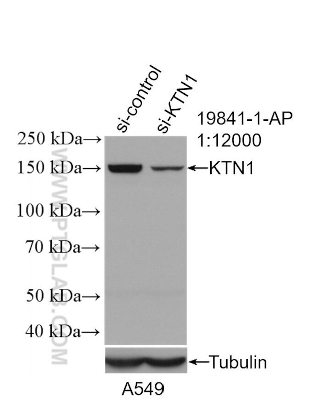 KTN1 Antibody in Western Blot (WB)