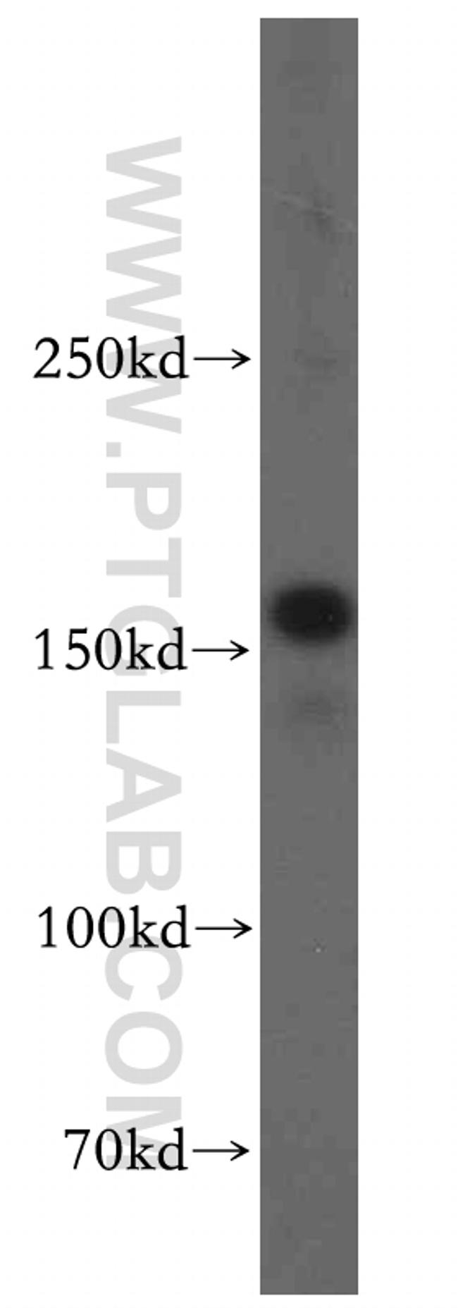 KTN1 Antibody in Western Blot (WB)