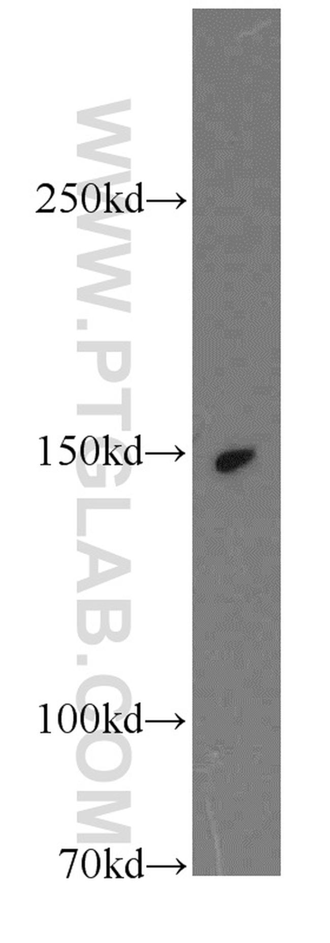 KTN1 Antibody in Western Blot (WB)