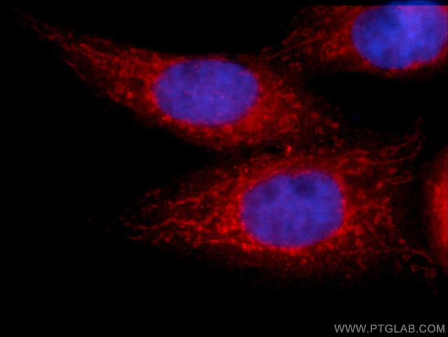 hIST1 Antibody in Immunocytochemistry (ICC/IF)