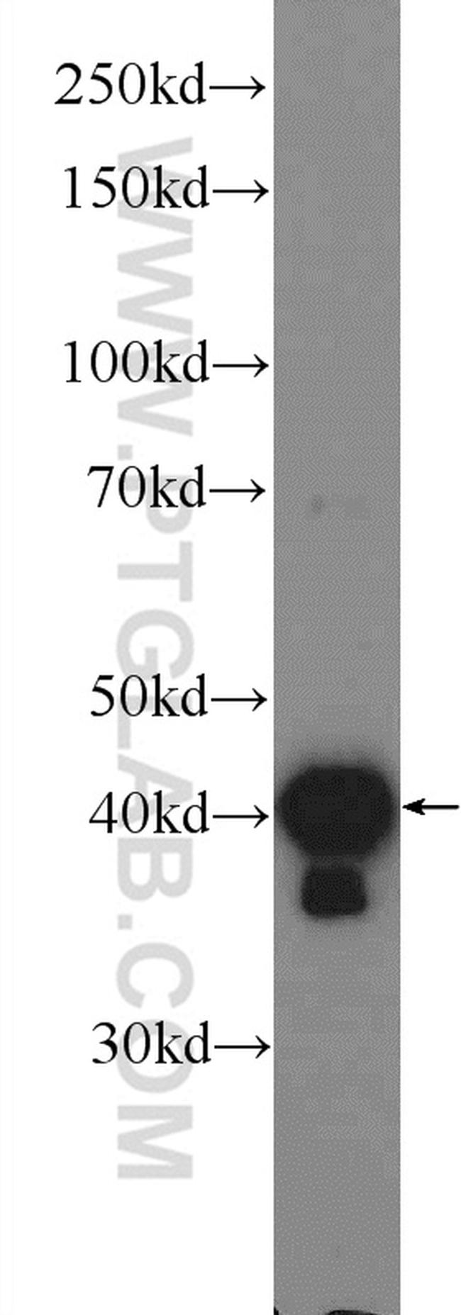 hIST1 Antibody in Western Blot (WB)