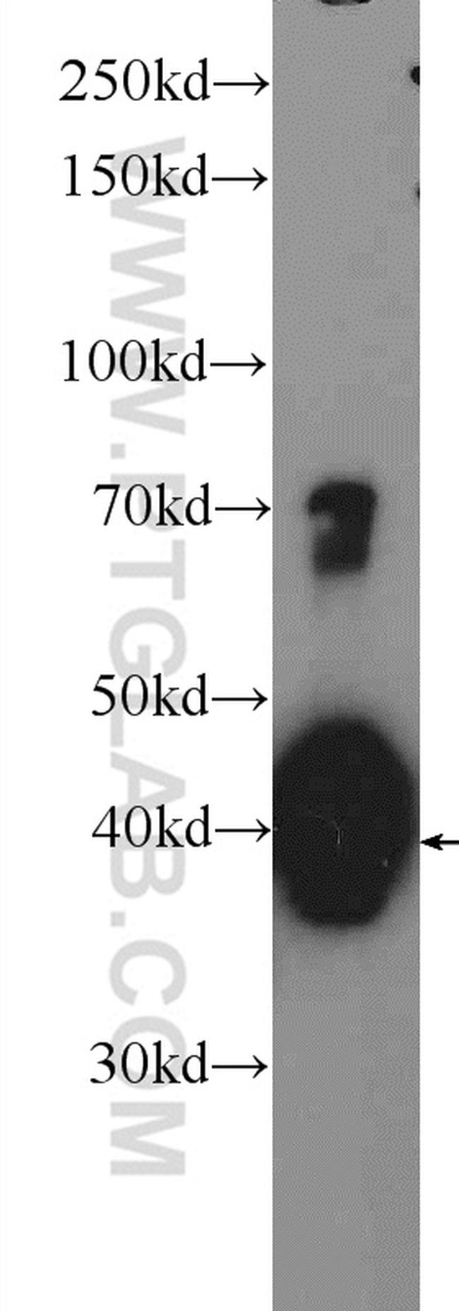 hIST1 Antibody in Western Blot (WB)