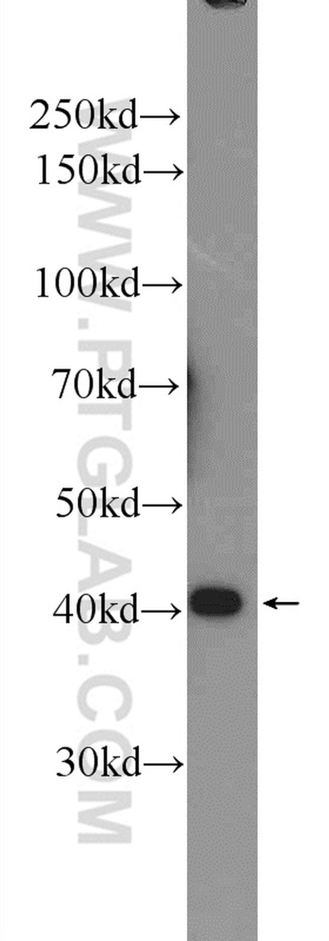 hIST1 Antibody in Western Blot (WB)